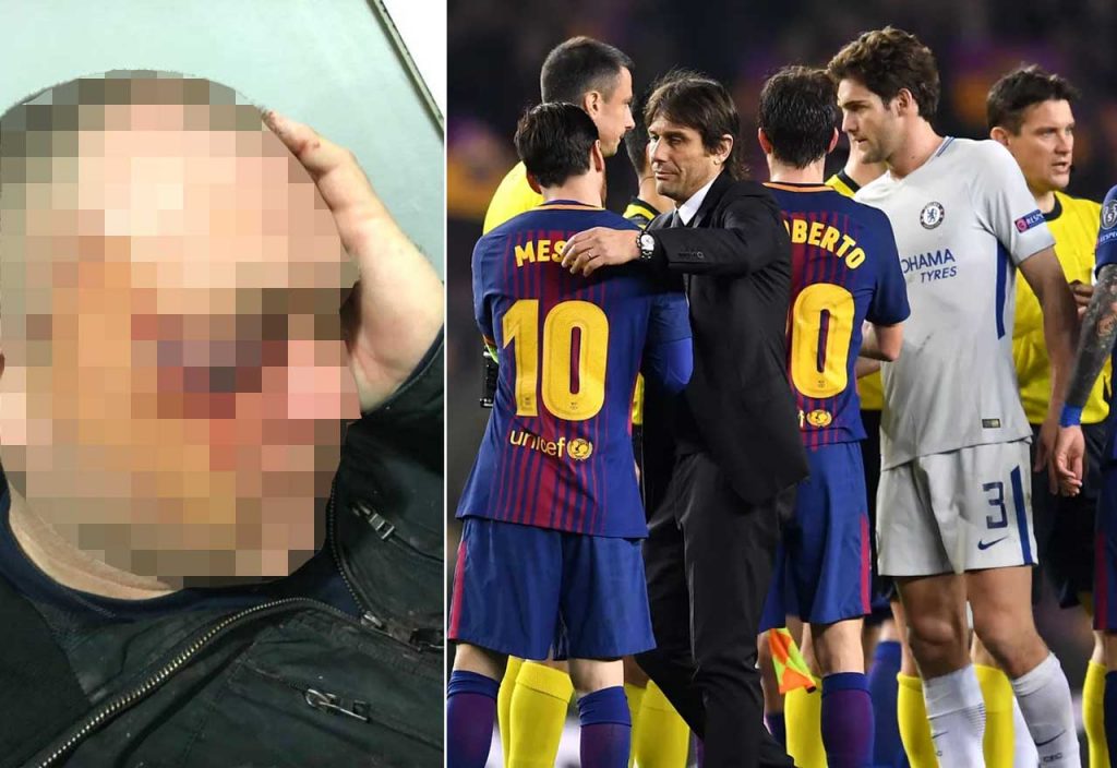 Barcelona Damage