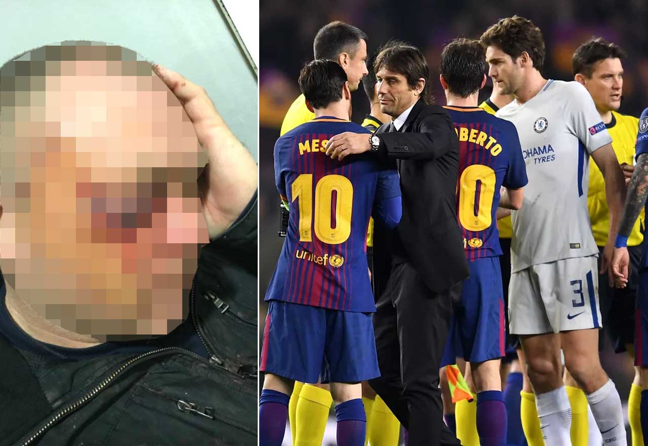 Barcelona Damage