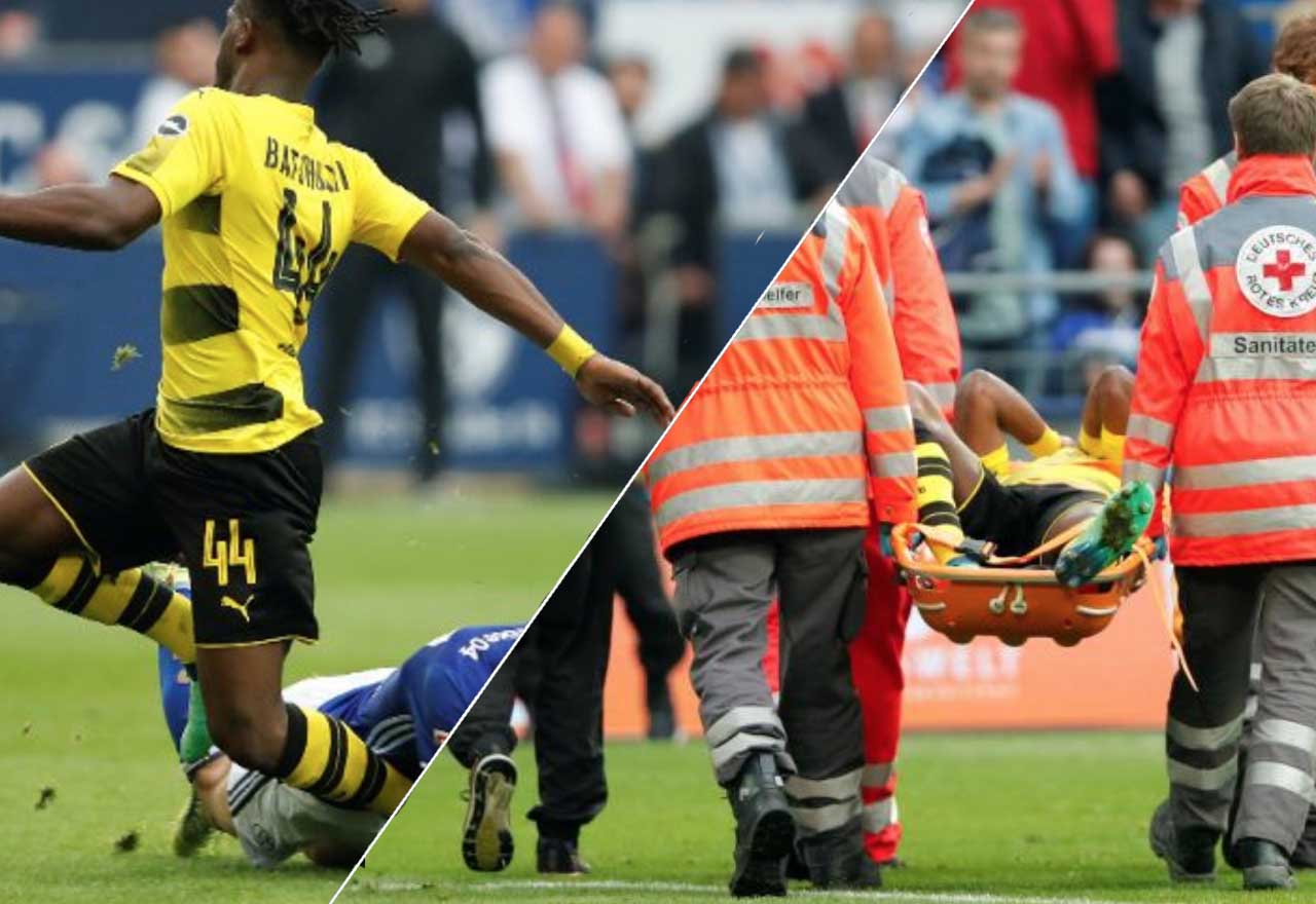 Batshuayi Leg Break